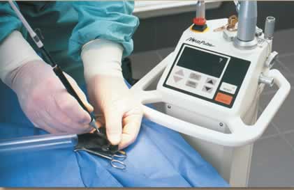 laser surgery laser surgery